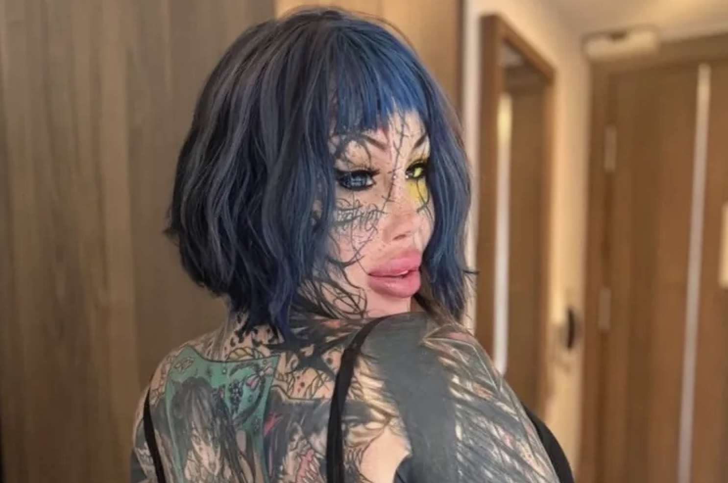 Plastic Surgery Influencer and OnlyFans Star Passes Away at 33